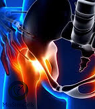 Slider image (8) MexStemCells Clinic